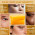Organic Honey Turmeric Kojic Acid Soap Bars, Dark Spot Remover with Vit C, Retinol, Collagen, and Hyaluronic Acid
