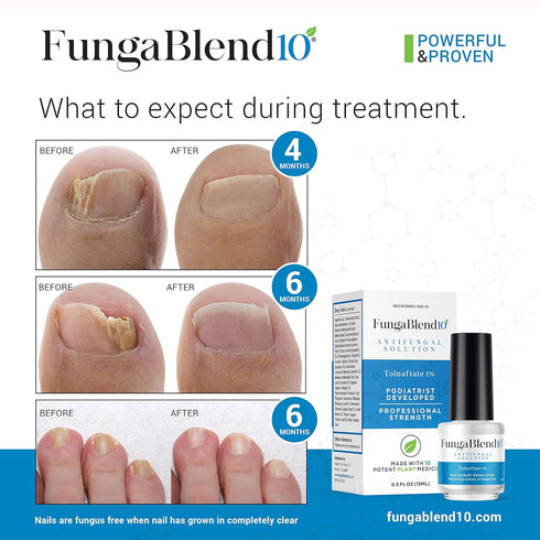Antifungal Medication: 1% Tolnaftate & 10 Plant Medicines - Toenail Fungus Treatment Gel, Athletes Foot, Jock Itch