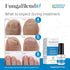 Antifungal Medication: 1% Tolnaftate & 10 Plant Medicines - Toenail Fungus Treatment Gel, Athletes Foot, Jock Itch