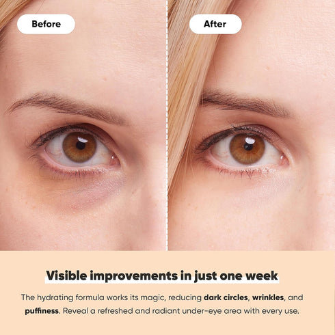 LE GUSHE Under Eye Mask & Patches (20 Pairs) - Gold Eye Mask with Collagen & Amino Acid for Puffy Eyes & Dark Circles
