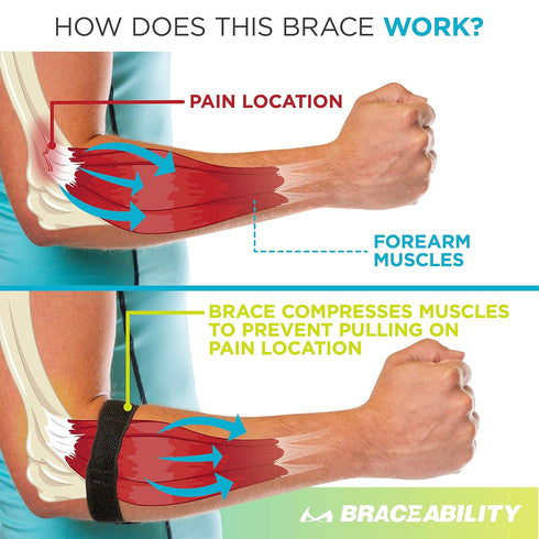 BraceAbility Epicondylitis Brace | Elbow Strap for Medial/Lateral Pain and Tendonitis Support Band, One Size
