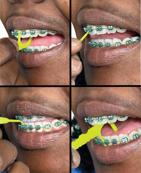 Braces Flosser | Ortho Floss | 200 Count Bag | Pack of 4 | Soft Bristle Orthodontic Toothbrush for Cleaning