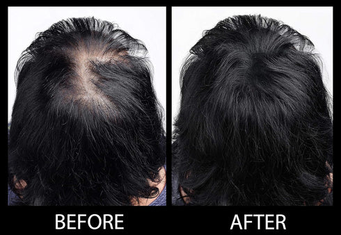 Volumizing Hair Fibers with Real Keratin for Thinning Hair, 60 Days+ Supply, Dermatologist Tested, Black