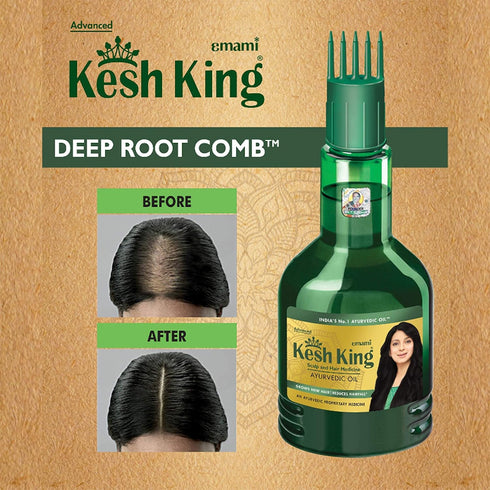 Ayurvedic Hair Oil with Bhringraj & Amla, 10.14 Fl Oz/300ml, Enhances Hair Growth and Reduces Hairfall