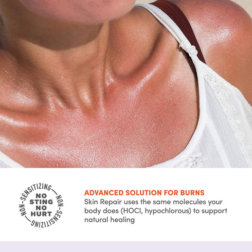 Active Skin Repair First Aid Hydrogel, 3 oz Skin Healing Burn Ointment - Natural, Non-Toxic, No Sting for Immediate