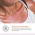 Active Skin Repair First Aid Hydrogel, 3 oz Skin Healing Burn Ointment - Natural, Non-Toxic, No Sting for Immediate
